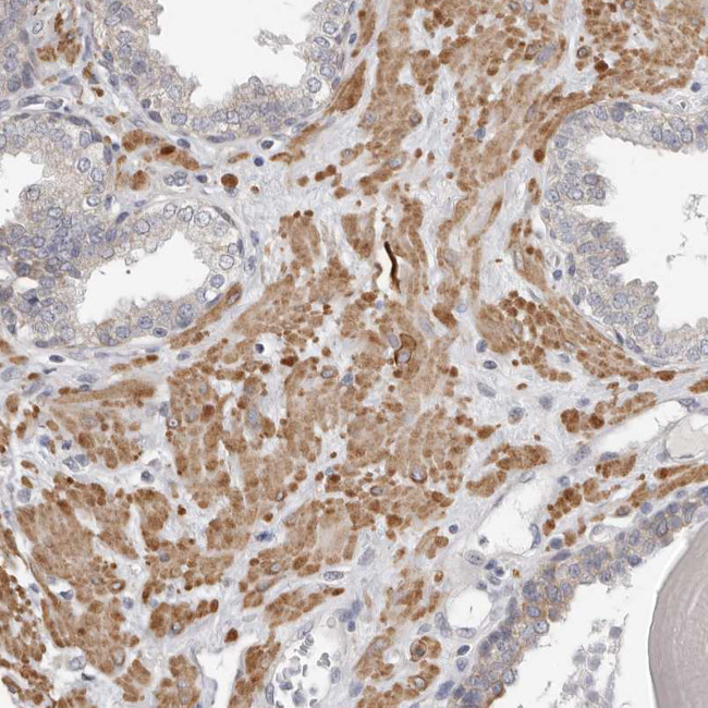 UNK Antibody in Immunohistochemistry (Paraffin) (IHC (P))