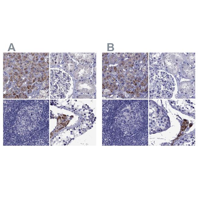 STAR Antibody in Immunohistochemistry (IHC)