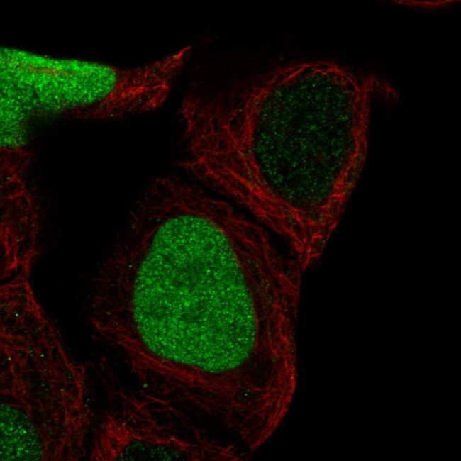 CDCA5 Antibody in Immunocytochemistry (ICC/IF)