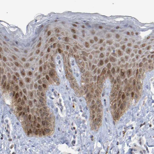 ESRP1 Antibody in Immunohistochemistry (Paraffin) (IHC (P))