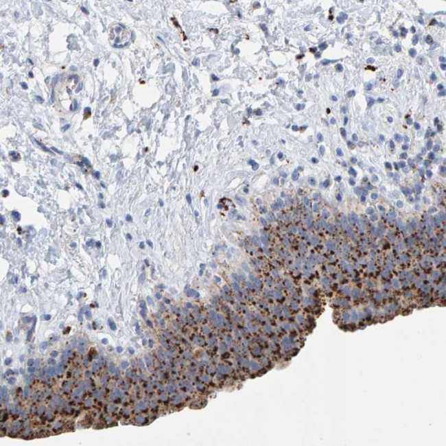 BIN3 Antibody in Immunohistochemistry (Paraffin) (IHC (P))