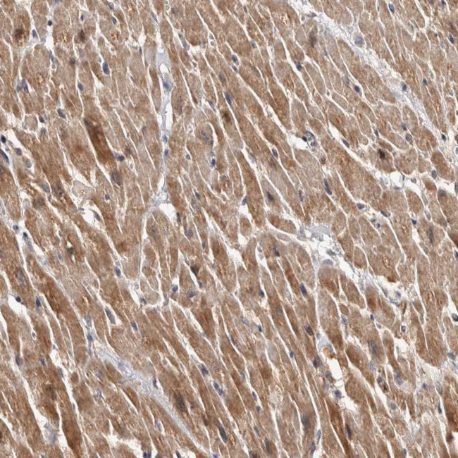 CHMP4C Antibody in Immunohistochemistry (Paraffin) (IHC (P))