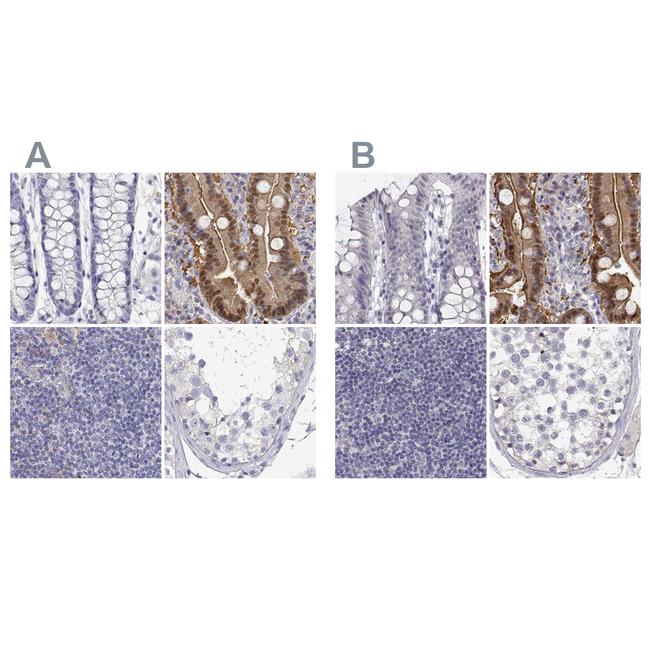 Adenosine Deaminase Antibody in Immunohistochemistry (IHC)