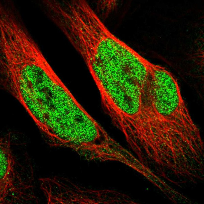 WIPF2 Antibody in Immunocytochemistry (ICC/IF)