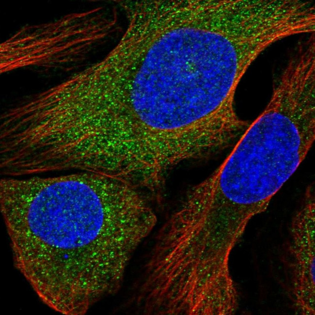 ALOX12B Antibody in Immunocytochemistry (ICC/IF)