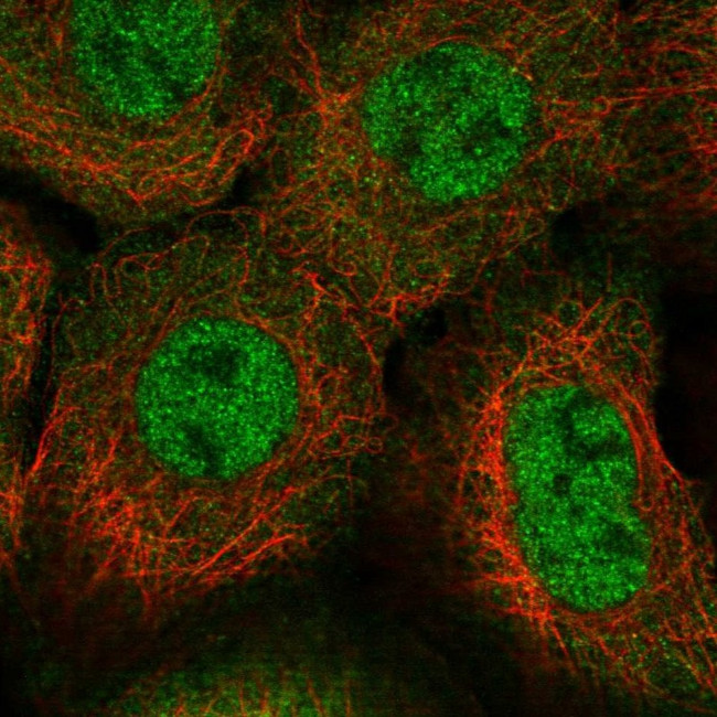 SKAP2 Antibody in Immunocytochemistry (ICC/IF)