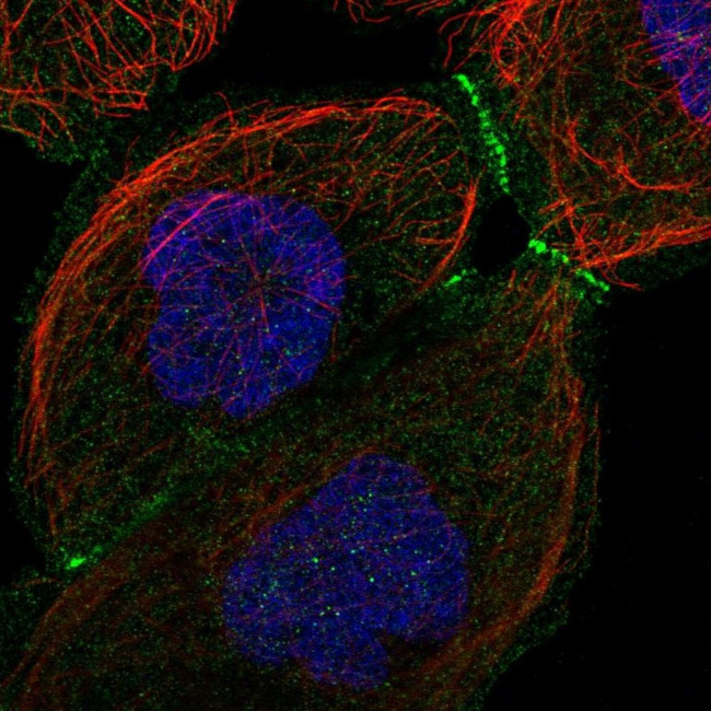 LMCD1 Antibody in Immunocytochemistry (ICC/IF)