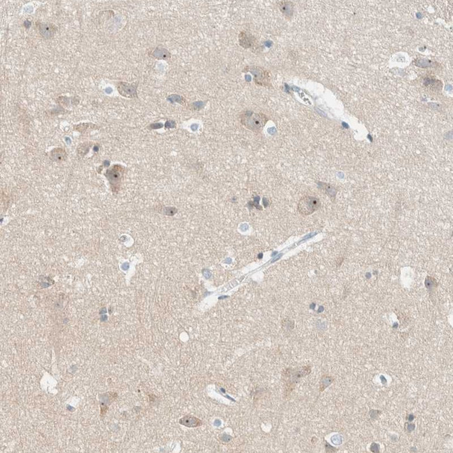 NDE1 Antibody in Immunohistochemistry (Paraffin) (IHC (P))