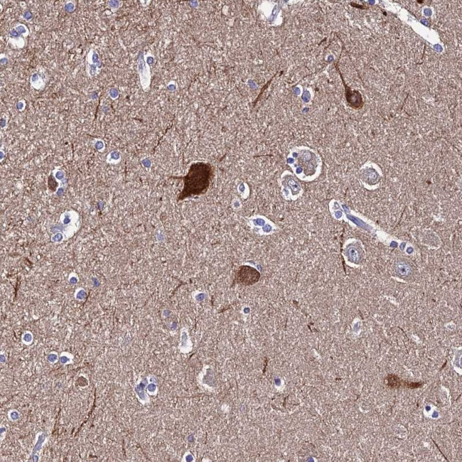 CEP41 Antibody in Immunohistochemistry (Paraffin) (IHC (P))