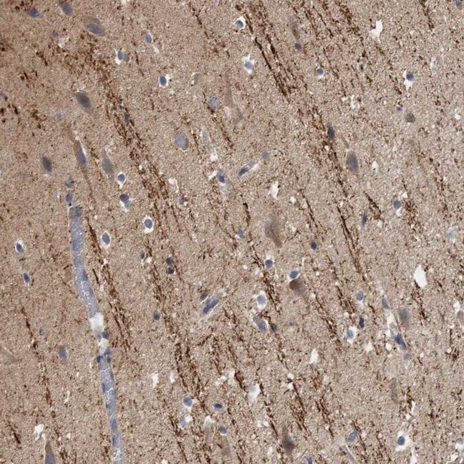 CAMSAP1 Antibody in Immunohistochemistry (IHC)