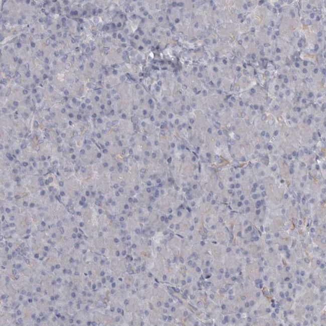 PPP1R12B Antibody in Immunohistochemistry (Paraffin) (IHC (P))