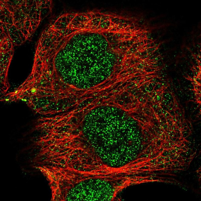 TRIT1 Antibody in Immunocytochemistry (ICC/IF)