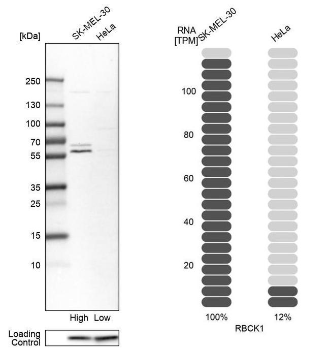 RBCK1 Antibody in Western Blot (WB)