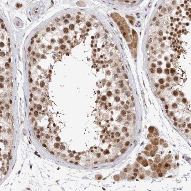 HESX1 Antibody in Immunohistochemistry (IHC)