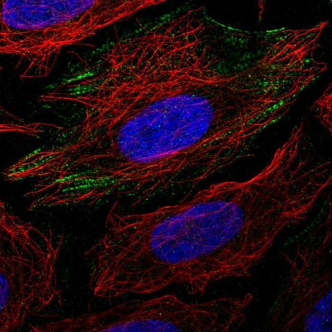 PGM1 Antibody in Immunocytochemistry (ICC/IF)