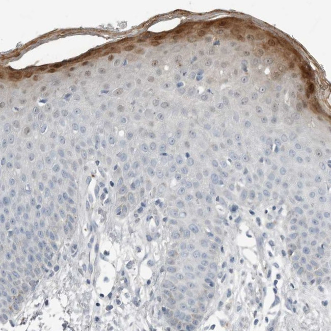 SERPINB7 Antibody in Immunohistochemistry (Paraffin) (IHC (P))