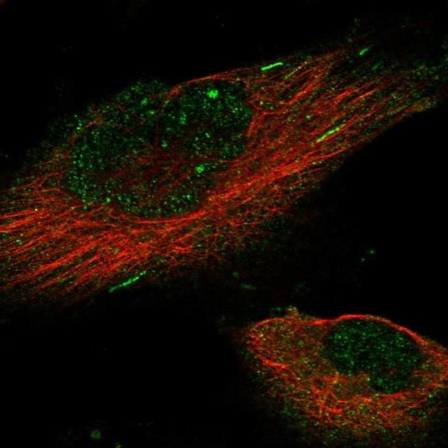 KIF18B Antibody in Immunocytochemistry (ICC/IF)