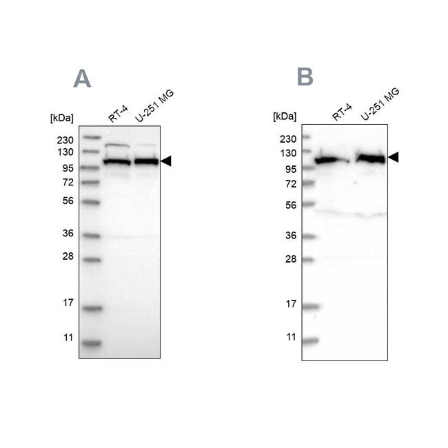 IARS2 Antibody in Western Blot (WB)