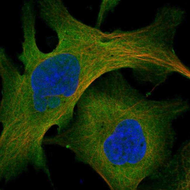 MYO10 Antibody in Immunocytochemistry (ICC/IF)