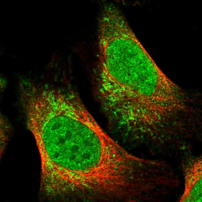 TNRC18 Antibody in Immunocytochemistry (ICC/IF)