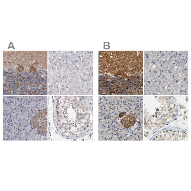 GDAP1 Antibody in Immunohistochemistry (IHC)