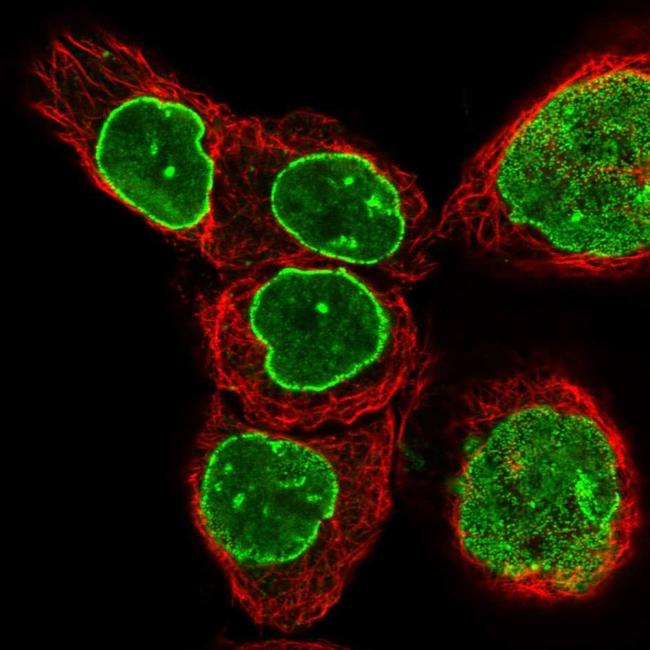 TPR Antibody in Immunocytochemistry (ICC/IF)