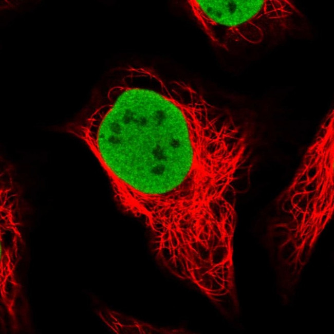 SMARCC1 Antibody in Immunocytochemistry (ICC/IF)