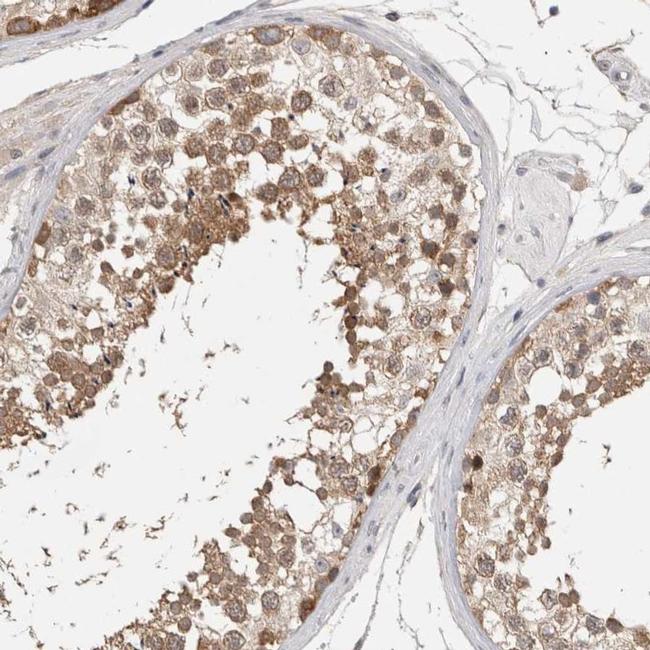 Lass3 Antibody in Immunohistochemistry (IHC)