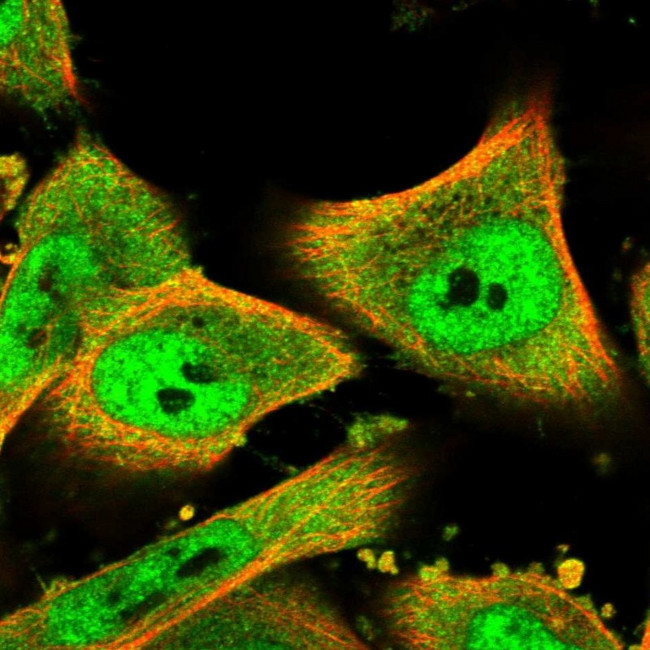 ZNF282 Antibody in Immunocytochemistry (ICC/IF)