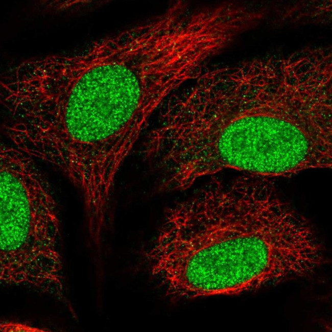 SNAPC5 Antibody in Immunocytochemistry (ICC/IF)