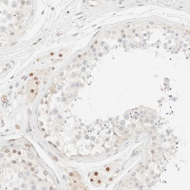 TSR1 Antibody in Immunohistochemistry (IHC)