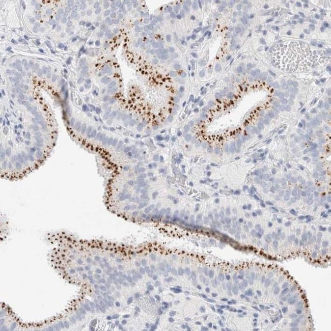 PGCP Antibody in Immunohistochemistry (IHC)