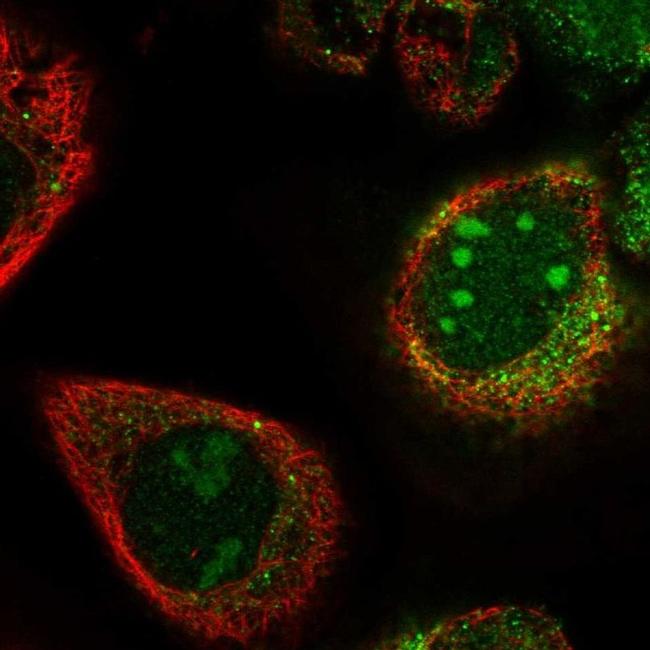 PWP2 Antibody in Immunocytochemistry (ICC/IF)