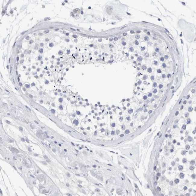 SLC22A12 Antibody in Immunohistochemistry (Paraffin) (IHC (P))