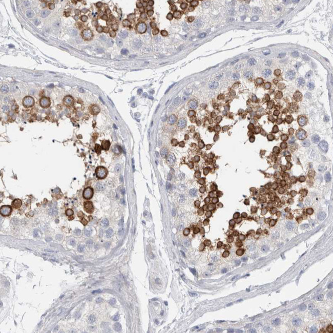 ADAM2 Antibody in Immunohistochemistry (Paraffin) (IHC (P))