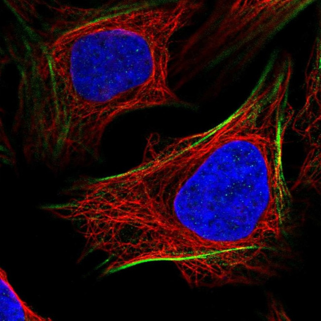 PGM1 Antibody in Immunocytochemistry (ICC/IF)