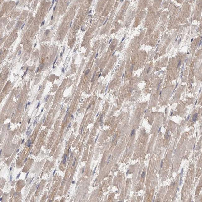 FHOD3 Antibody in Immunohistochemistry (IHC)