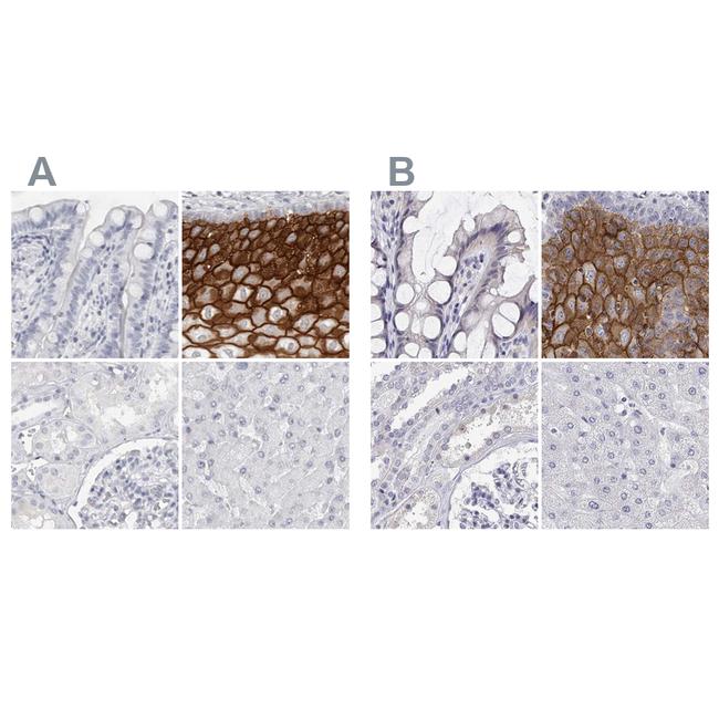 LY6D Antibody in Immunohistochemistry (IHC)