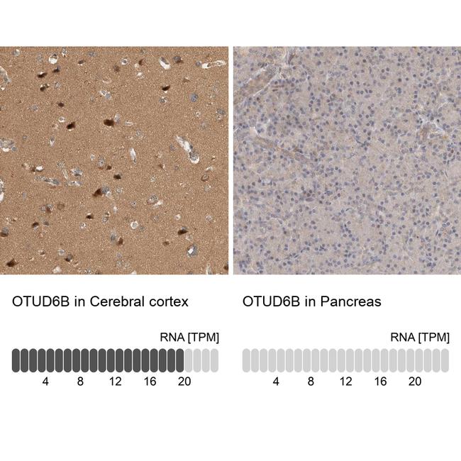 OTUD6B Antibody in Immunohistochemistry (IHC)