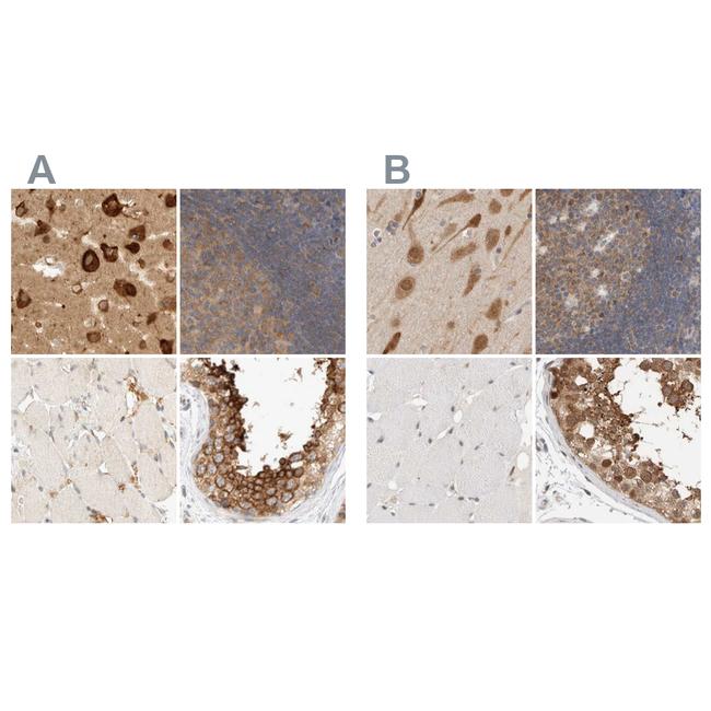 eIF4G3 Antibody in Immunohistochemistry (IHC)