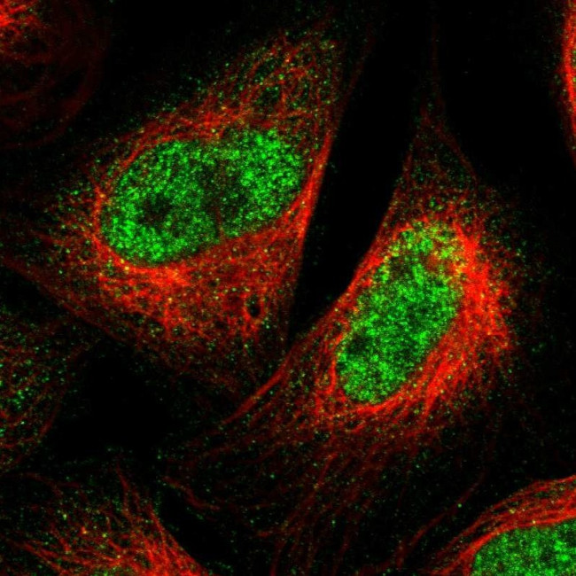 SPRTN Antibody in Immunocytochemistry (ICC/IF)