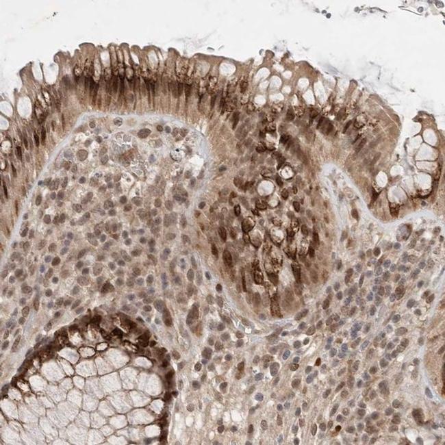 MAN1 Antibody in Immunohistochemistry (IHC)