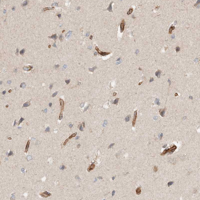 RAB32 Antibody in Immunohistochemistry (Paraffin) (IHC (P))