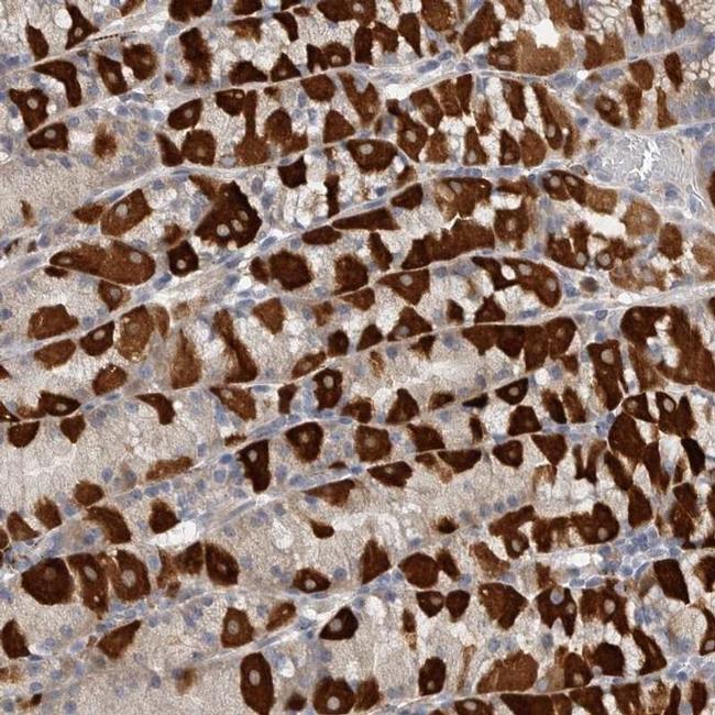 EDEM3 Antibody in Immunohistochemistry (IHC)