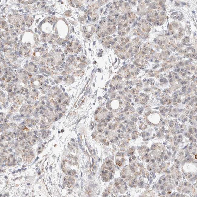 MRPL37 Antibody in Immunohistochemistry (IHC)