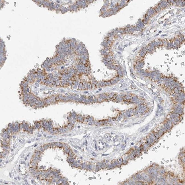 ELP3 Antibody in Immunohistochemistry (IHC)