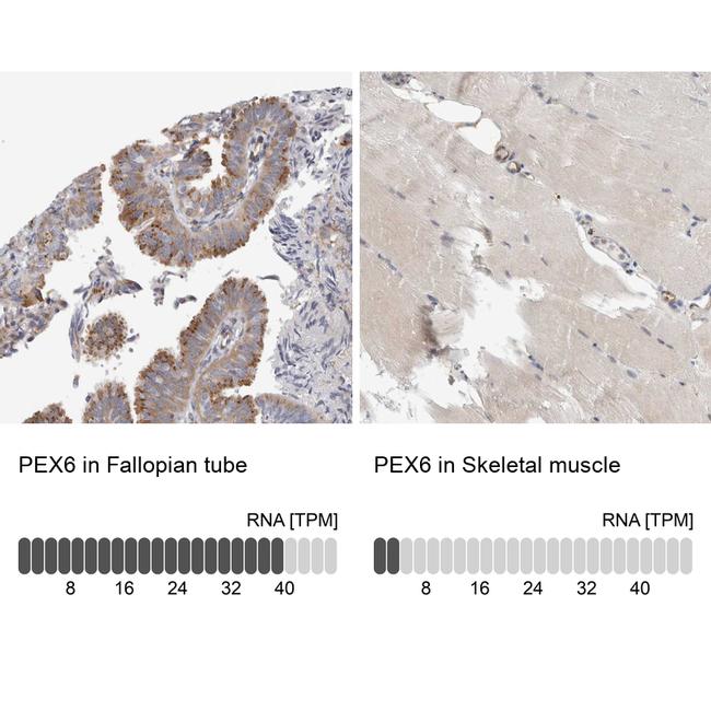 PEX6 Antibody in Immunohistochemistry (IHC)