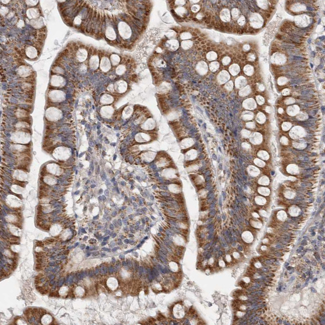 RAB18 Antibody in Immunohistochemistry (Paraffin) (IHC (P))