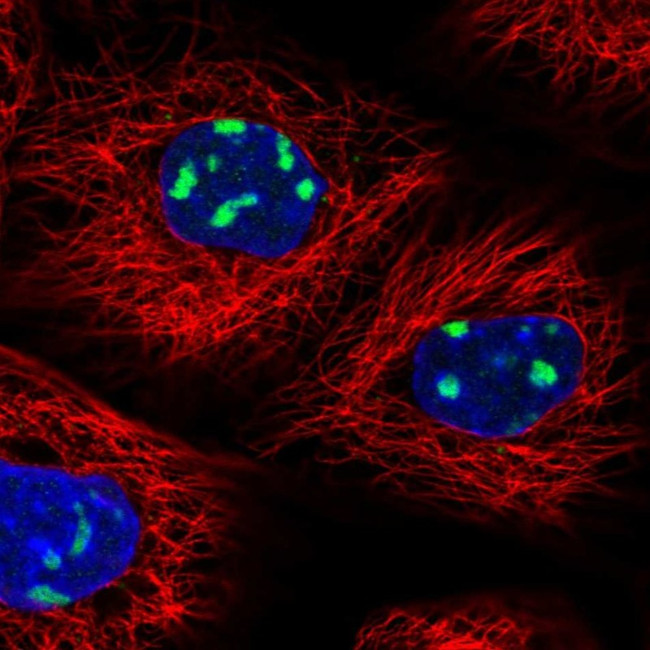 UTP6 Antibody in Immunocytochemistry (ICC/IF)