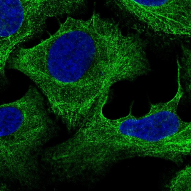 Plectin Antibody in Immunocytochemistry (ICC/IF)